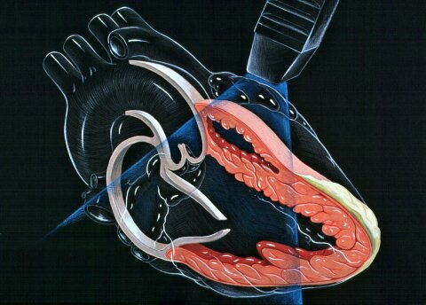 УЗИ сердца (эхокардиография, ЭхоКГ), многопрофильная клиника  МедПросвет