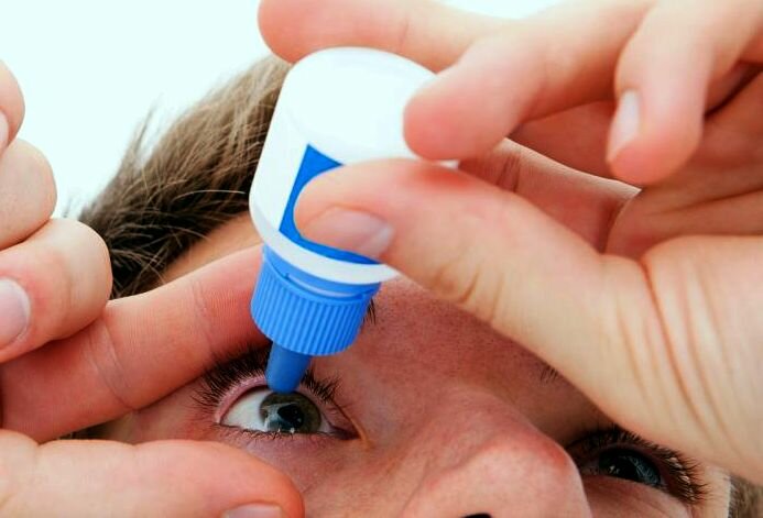 Синдром сухого глаза, многопрофильная клиника  МедПросвет