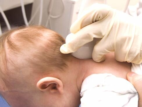 УЗИ головного мозга (нейросонография) новорожденным и детям до 1 года, многопрофильная клиника  МедПросвет