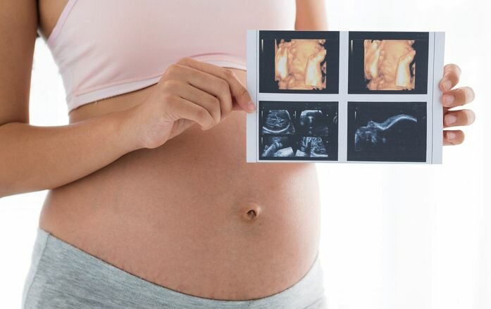 УЗИ при беременности, многопрофильная клиника  МедПросвет