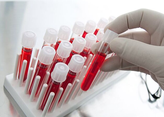 Анализ группы крови и резус-фактора, многопрофильная клиника  МедПросвет