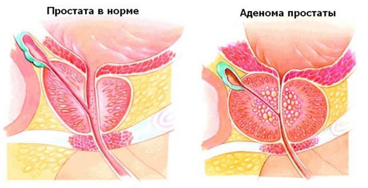 Мужские яички под ударом