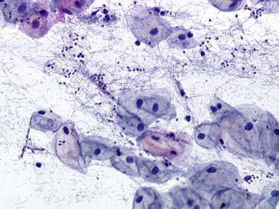 Gardnerella vaginalis под микроскопом