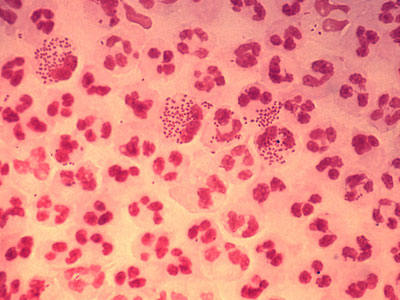 Neisseria gonorrhoeae под микроскопом