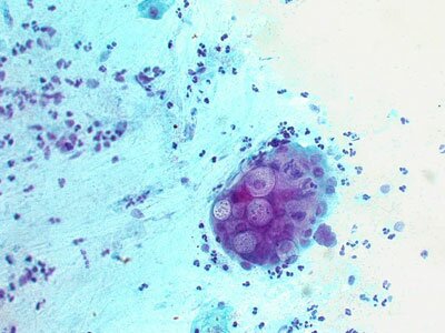 Chlamydia под микроскопом