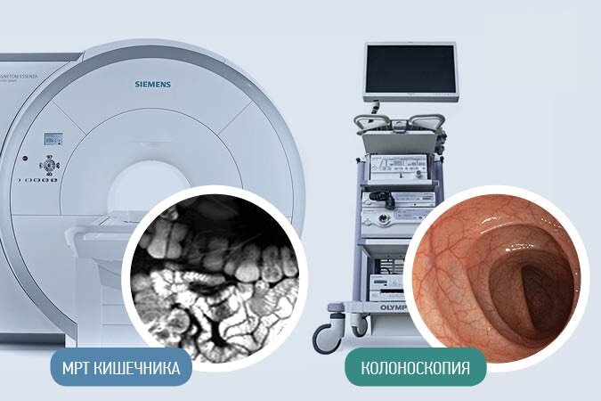 МРТ или колоноскопия кишечника выбор картинка