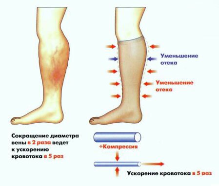 Опухла рука после забора крови