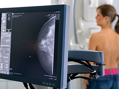 рак молочной железы диагностика маммография картинка
