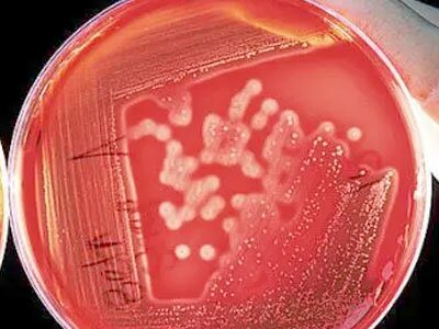 Ureaplasma под микроскопом