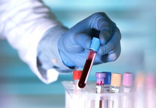 Клинический (общий) анализ крови, многопрофильная клиника  МедПросвет