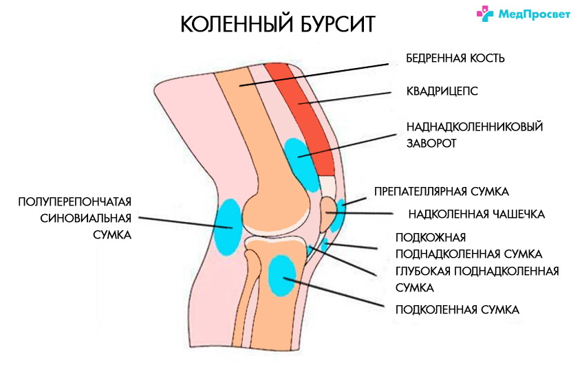 Причина боли с внутренней стороны колена