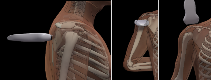 УЗИ плечевого сустава (плеча), многопрофильная клиника  МедПросвет