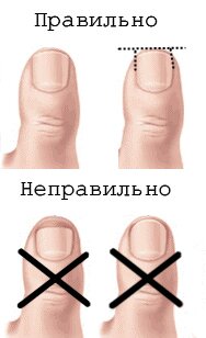Лечение вросшего ногтя, многопрофильная клиника  МедПросвет